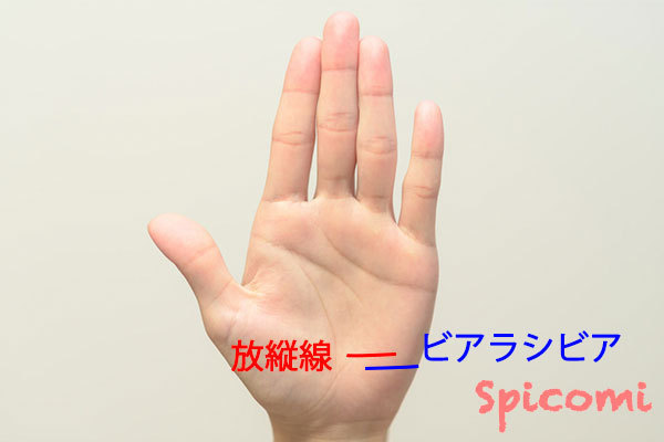 放縦線とビアラシビアの違い・見分け方