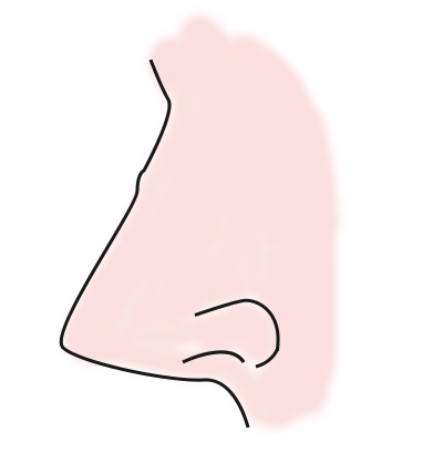 ローマ鼻の形の特徴3個