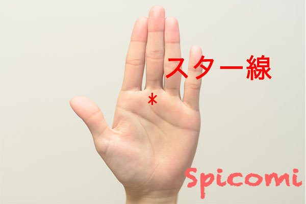 スター線(星紋)の意味と見方